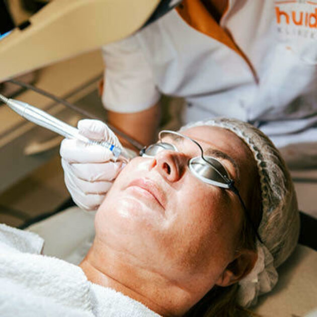 KTP laser behandeling Roodheid & Pigment De Huidkliniek