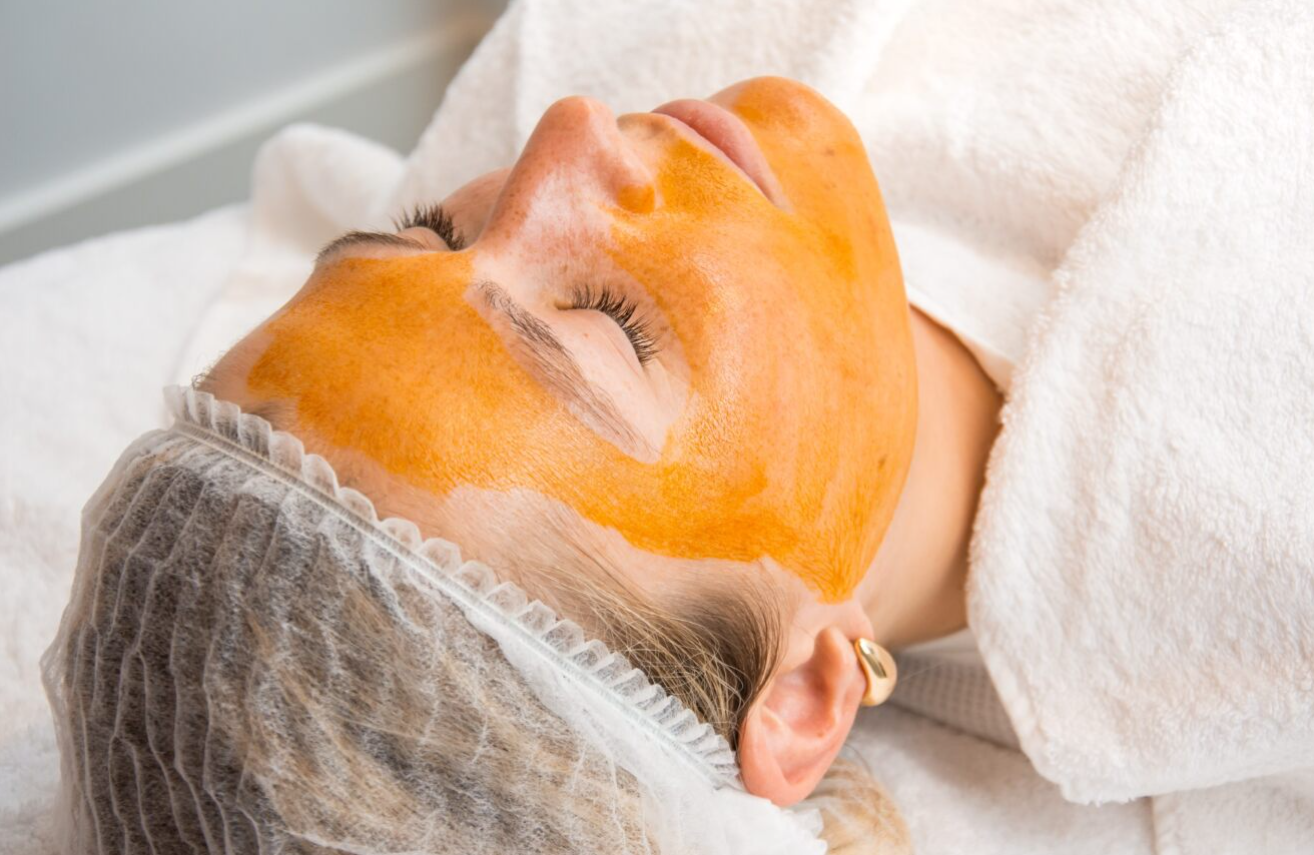 Vitamin C Peeling