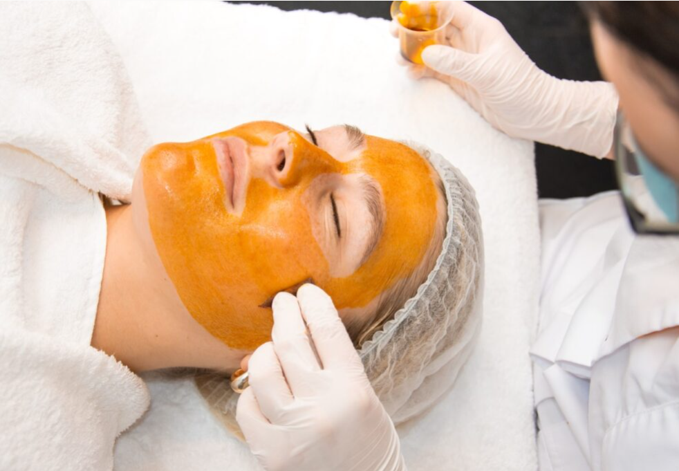 Vitamine C peeling