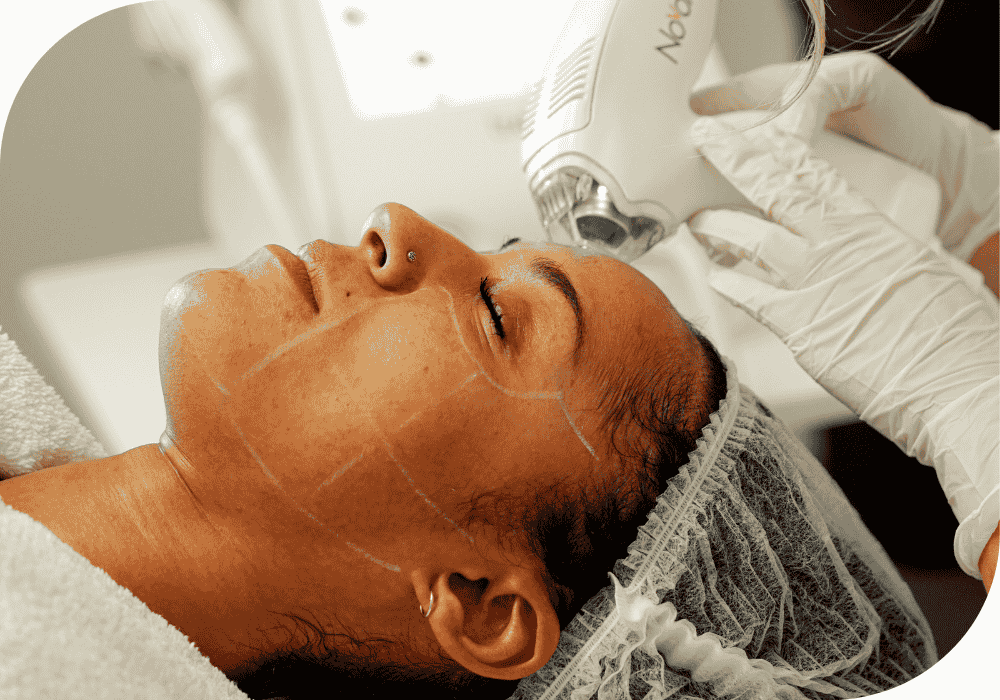 Natural Glow Treatment
